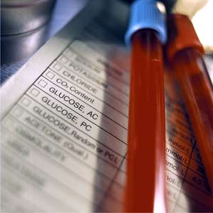 glucose testing